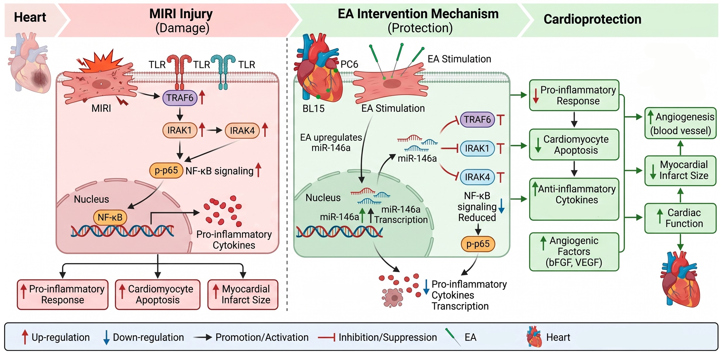 Electroacupuncture preconditioning alleviates myocardial ischemia-reperfusion injury through reducing the inflammatory response mediated by the miR-146a/TRAF6/IRAK4 pathway 